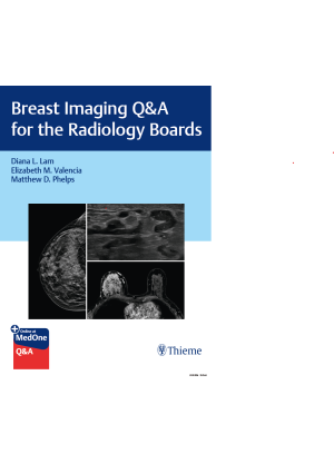 Breast Imaging Q&A for the Radiology Boards