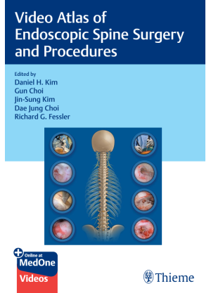 Video Atlas of  Endoscopic Spine Surgery  and Procedures
