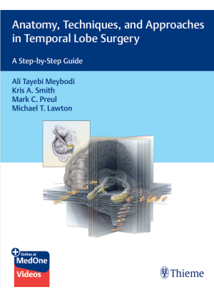 Anatomy, Techniques, and Approaches in Temporal Lobe Surgery: A Step-by-Step Guide