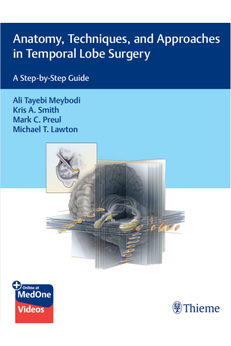 Anatomy, Techniques, and Approaches in Temporal Lobe Surgery: A Step-by-Step Guide