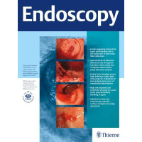 Endoscopy