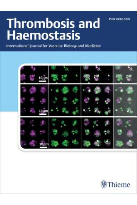 Thrombosis and Haemostasis