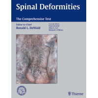 Spinal Deformities