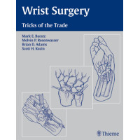 Wrist Surgery