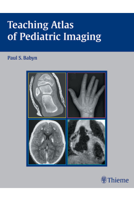 Teaching Atlas of Pediatric Imaging