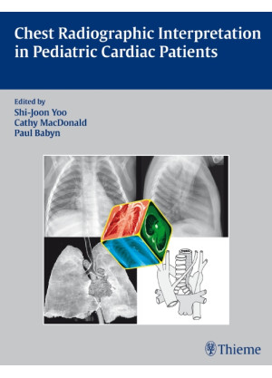 Chest Radiographic Interpretation in Pediatric Cardiac Patients