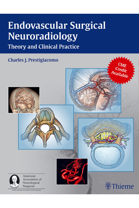 Endovascular Surgical Neuroradiology