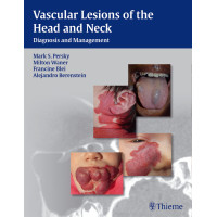 Vascular Lesions of the Head and Neck