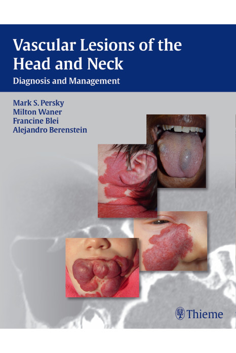 Vascular Lesions of the Head and Neck