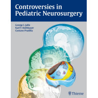 Controversies in Pediatric Neurosurgery