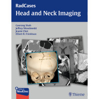 RadCases Head and Neck Imaging