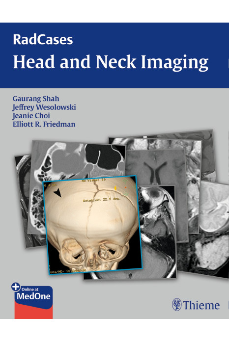 RadCases Head and Neck Imaging