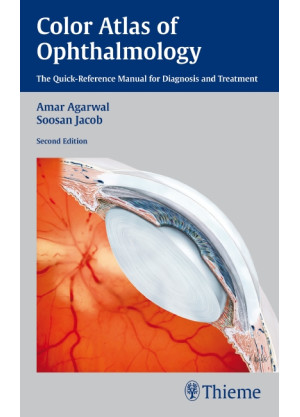 Color Atlas of Ophthalmology