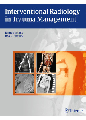 Interventional Radiology in Trauma