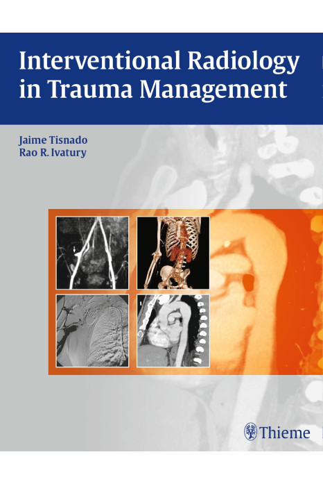 Interventional Radiology in Trauma