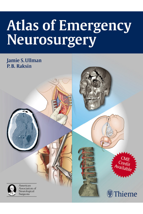 Atlas of Emergency Neurosurgery