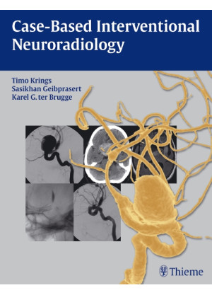 Case-Based Interventional Neuroradiology