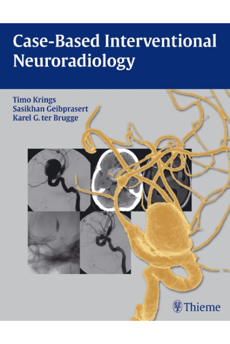 Case-Based Interventional Neuroradiology