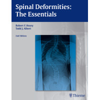 Spinal Deformities