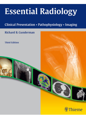 Essential Radiology