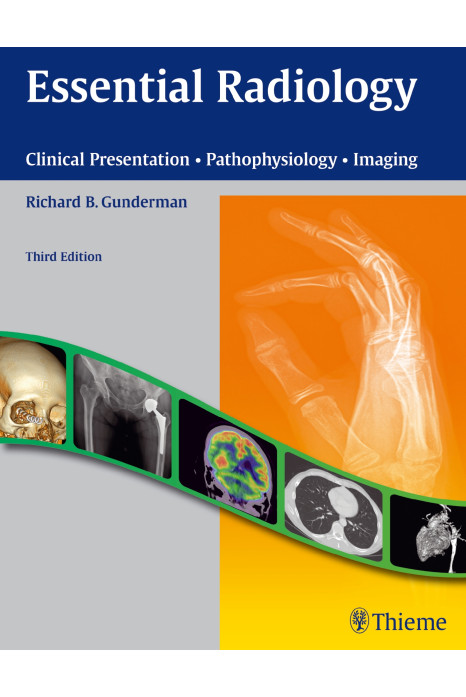 Essential Radiology