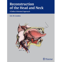 Reconstruction of the Head and Neck