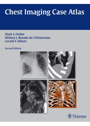 Chest Imaging Case Atlas