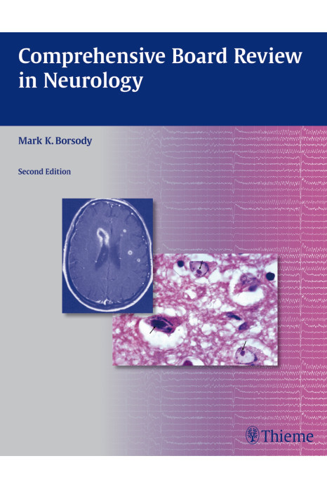 Comprehensive Board Review in Neurology