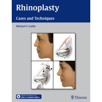 Rhinoplasty - Cases and Techniques