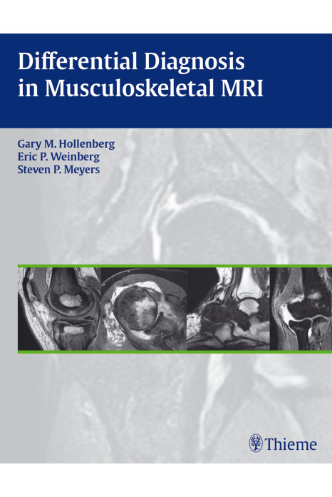 Differential Diagnosis in Musculoskeletal MR