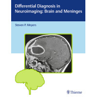 Differential Diagnosis in Neuroimaging: Brain and Meninges