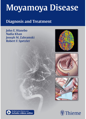 Moyamoya Disease