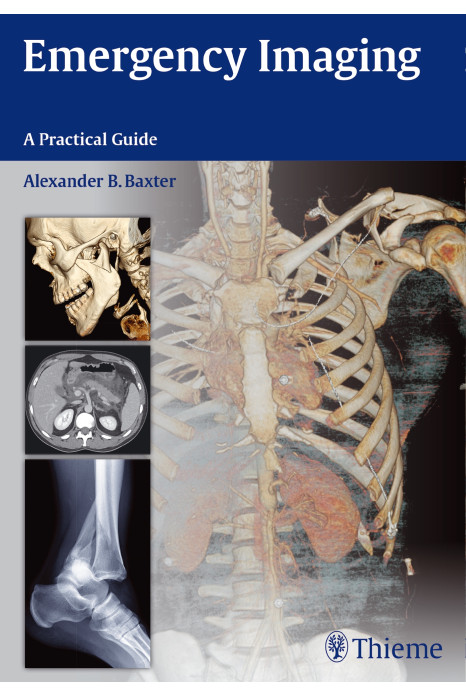 Emergency Imaging