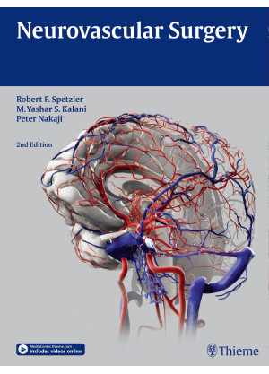 Neurovascular Surgery