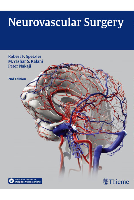 Neurovascular Surgery