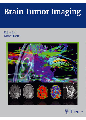 Brain Tumor Imaging