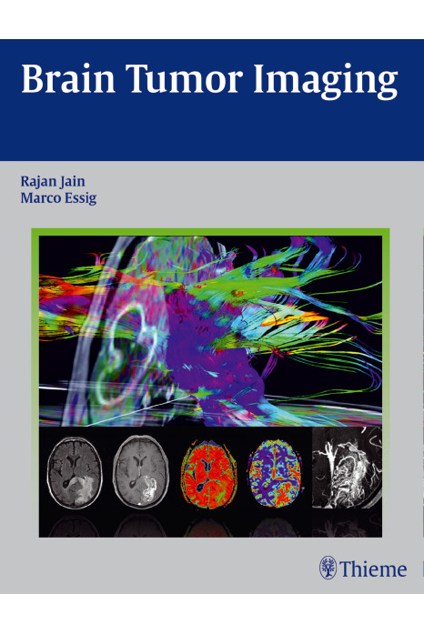 Brain Tumor Imaging