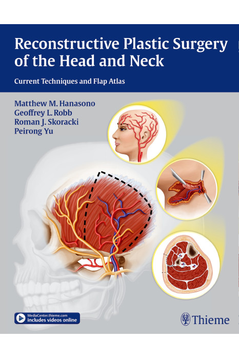 Reconstructive Plastic Surgery of the Head and Neck