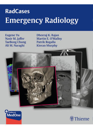 Radcases Emergency Radiology