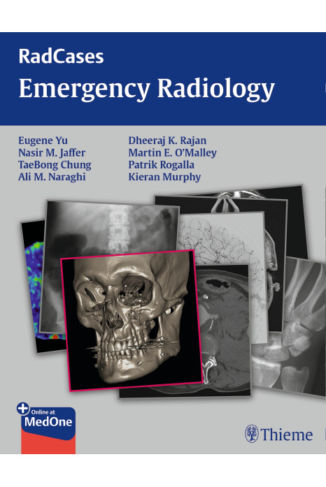 Radcases Emergency Radiology