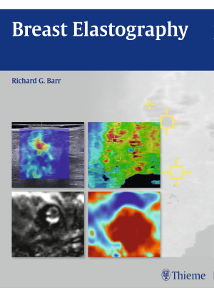 Breast Elastography