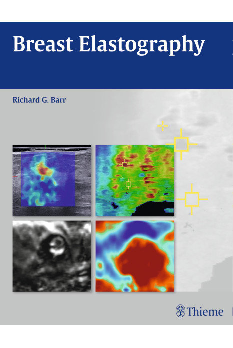 Breast Elastography