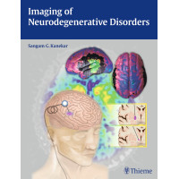 Imaging of Neurodegenerative Disorders