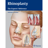 Rhinoplasty