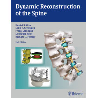 Dynamic Reconstruction of the Spine