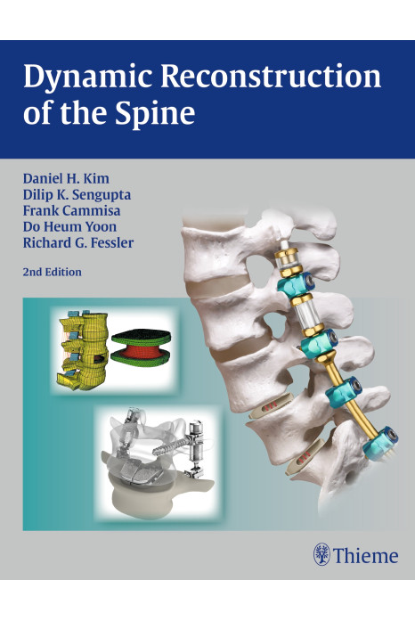 Dynamic Reconstruction of the Spine