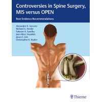 Controversies in Spine Surgery, MIS versus OPEN