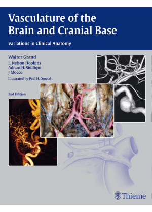 Vasculature of the Brain and Cranial Base