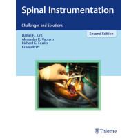 Spinal Instrumentation