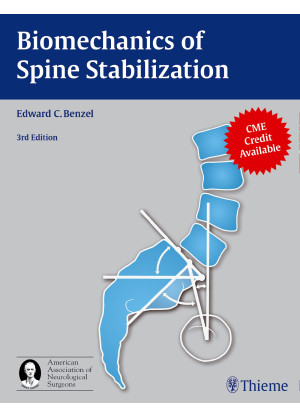 Biomechanics of Spine Stabilization